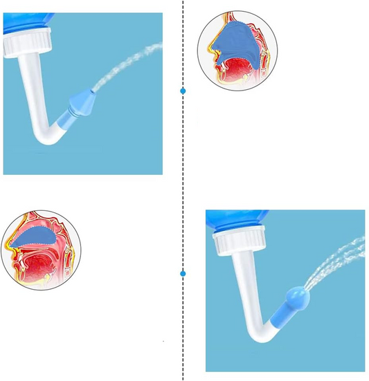 HOUDIAN Neti Pot irrigatore nasale per bambini e adulti 2 beccucci 300 ml