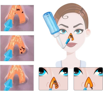 HOUDIAN Neti Pot irrigatore nasale per bambini e adulti 2 beccucci 300 ml
